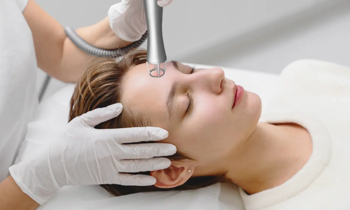 Fraktionierter CO2-Laser